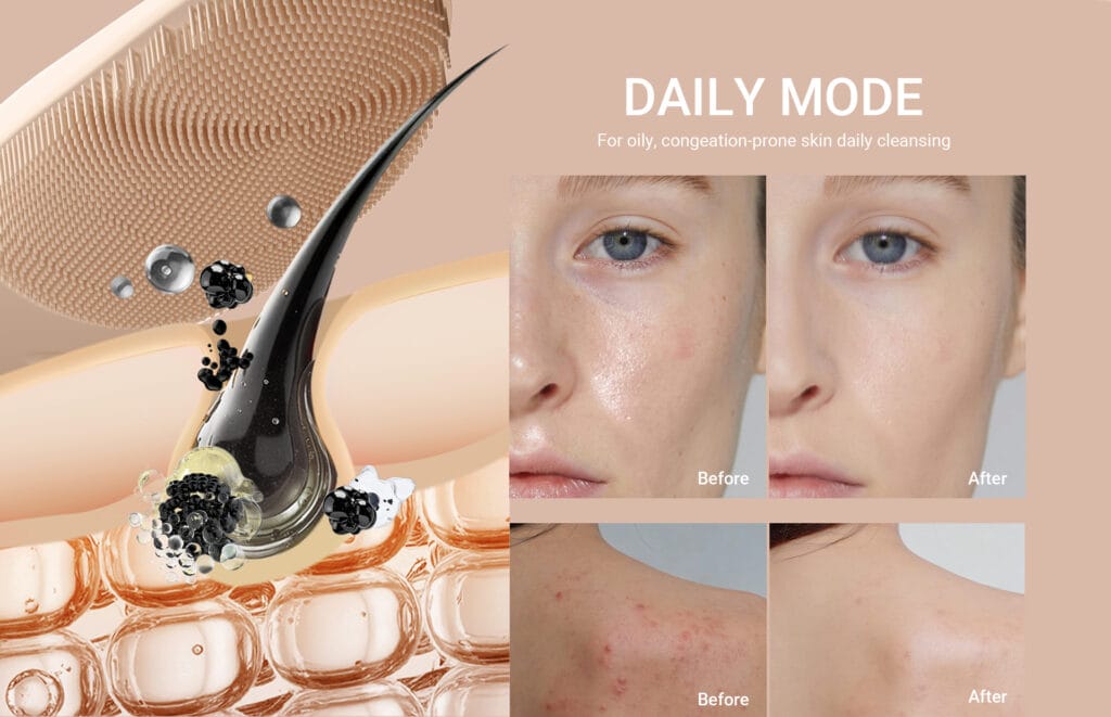 NICEMAY MR-2565 daily cleansing mode graphic for oily and congestion-prone skin.