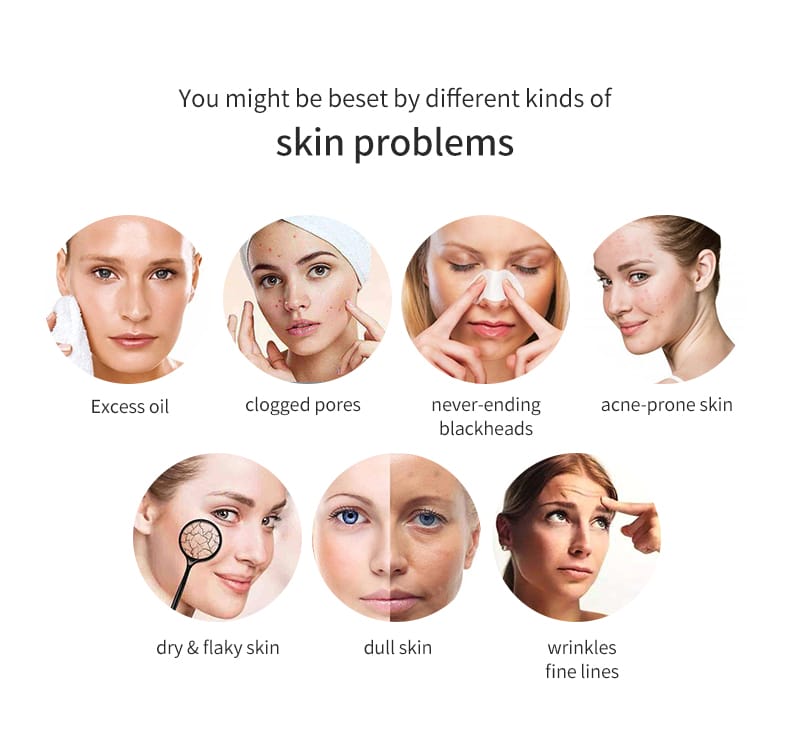 NICEMAY 1810 facial beauty device skincare benefit concept