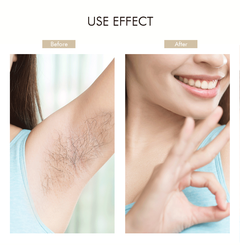 NICEMAY QM-2066 facial hair remover use effect comparison graphic